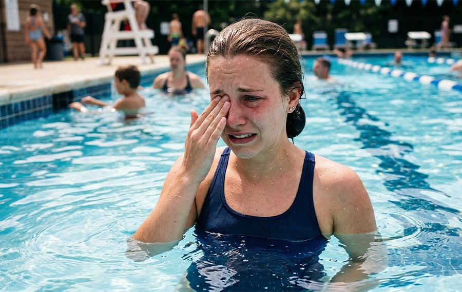 Havuzda kloramin nedeniyle göz yanması