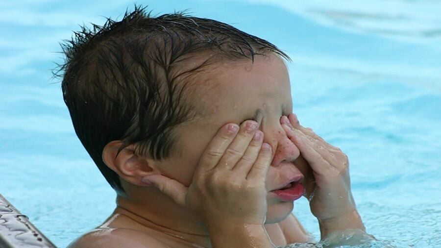 Havuz Suyu Dezenfeksiyon Yöntemleri Nelerdir?